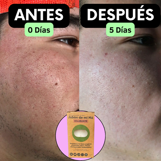 Doble Aclarado | 2 Aclarantes de Belleza mi Má