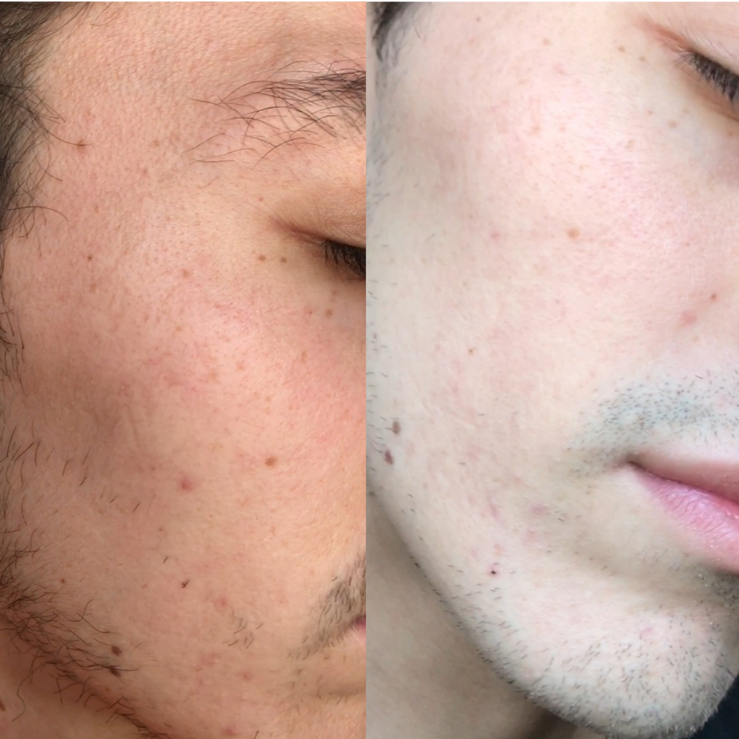 Crema Facial Aclaradora de Aloe Vera + Ácido Hialurónico Hidratante de Mi Má (110 ml)