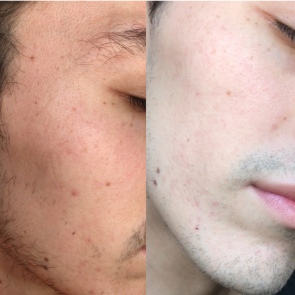 Crema Facial Aclaradora de Aloe Vera + Ácido Hialurónico Hidratante de Mi Má (110 ml)