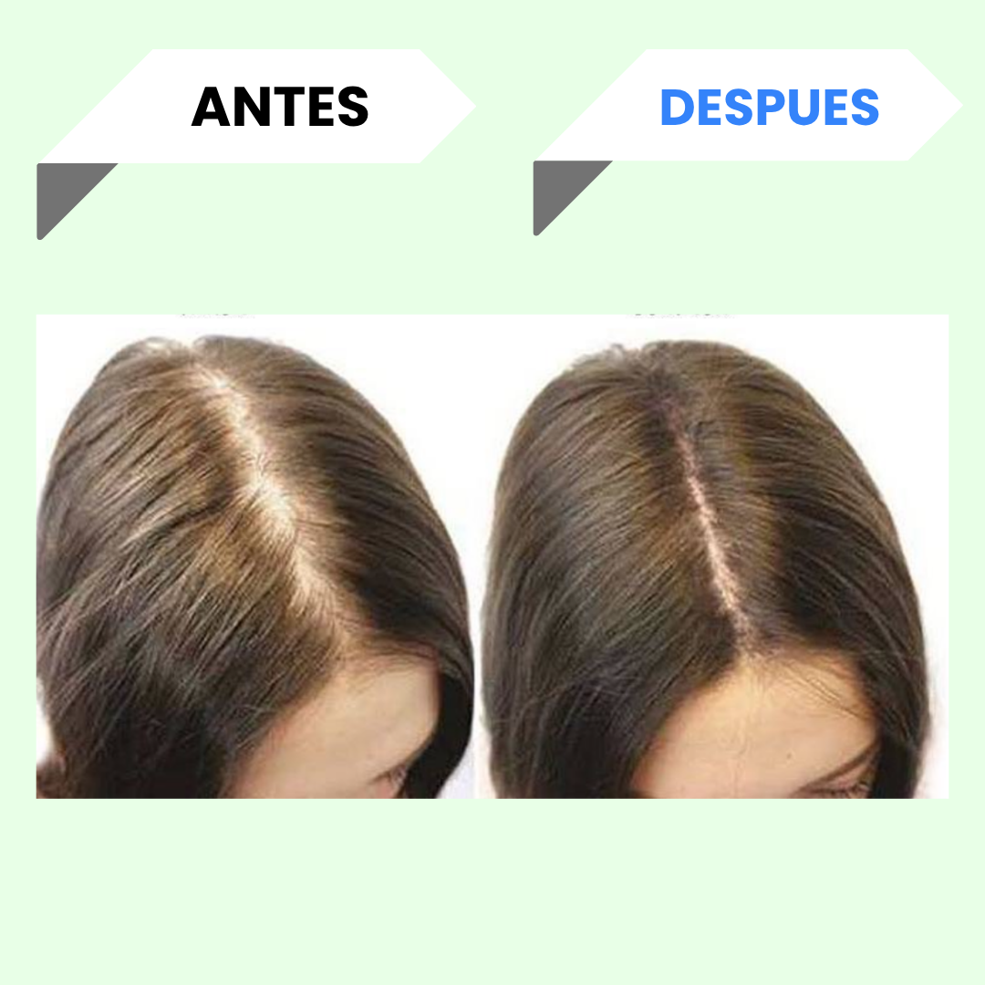 Shampoo de mi Má de Romero y Batamote | Fuerza y Brillo para Tu Cabello (250 ml)