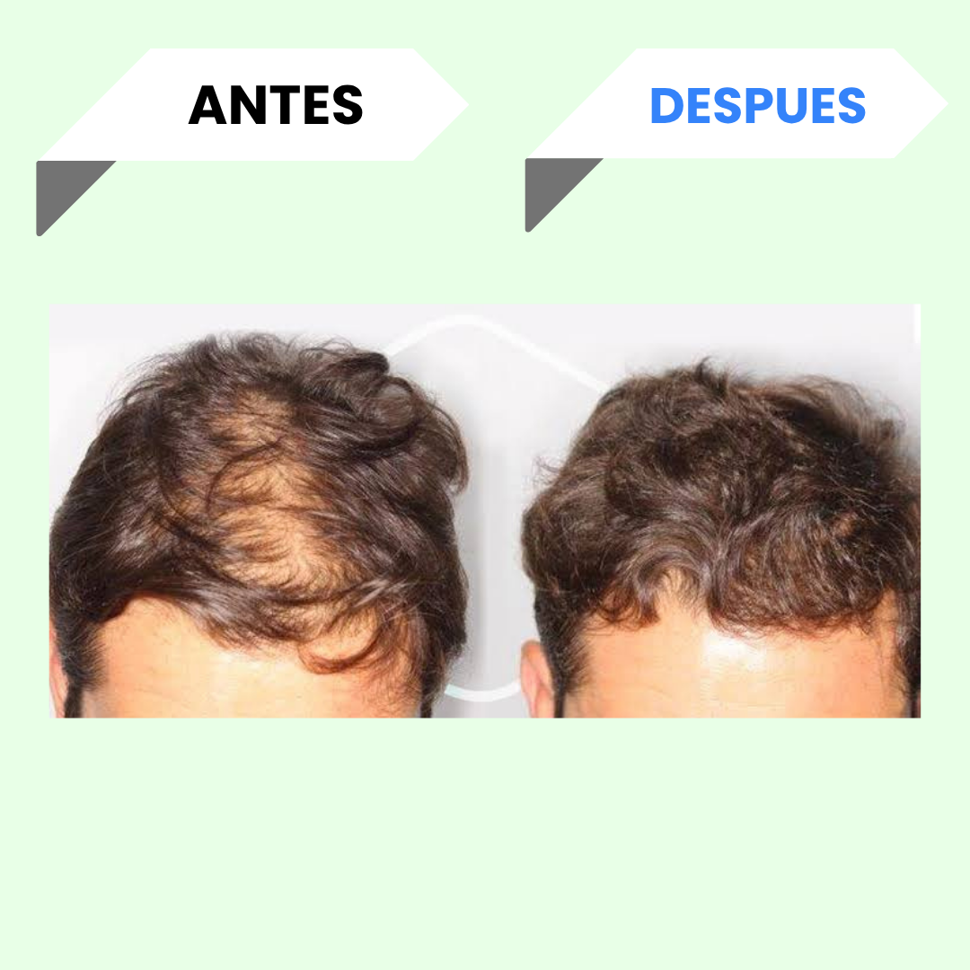 Shampoo de mi Má de Romero y Batamote | Fuerza y Brillo para Tu Cabello (250 ml)