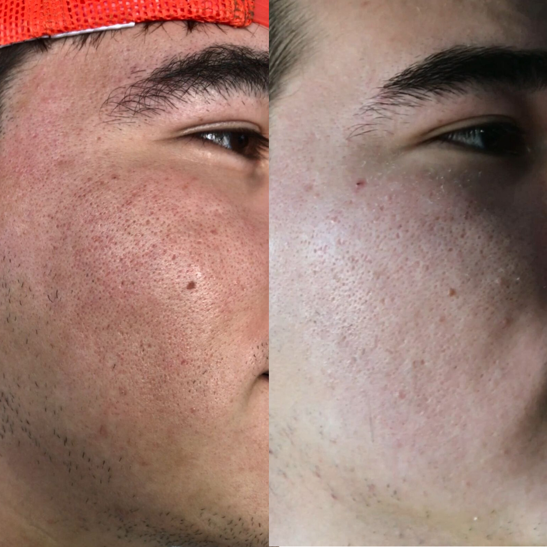 Crema Facial Aclaradora de Aloe Vera + Ácido Hialurónico Hidratante de Mi Má (110 ml)